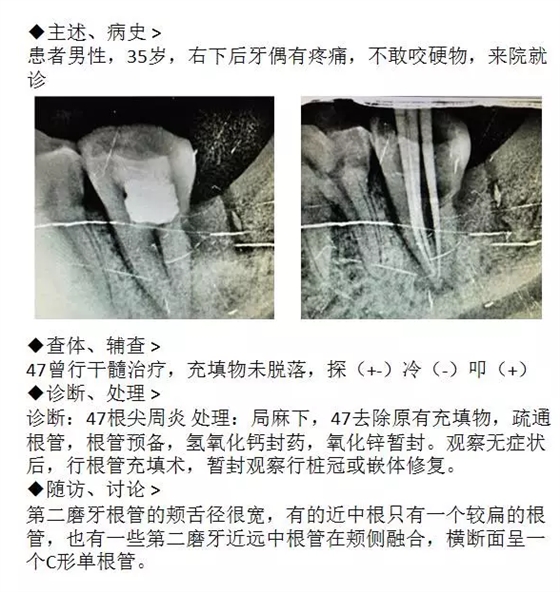 QQ圖片20150717110007.png