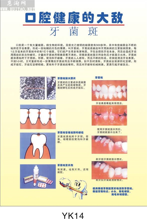 牙菌斑