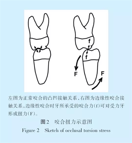 王美青.淺談咬合修復重建中的（牙合）學問題