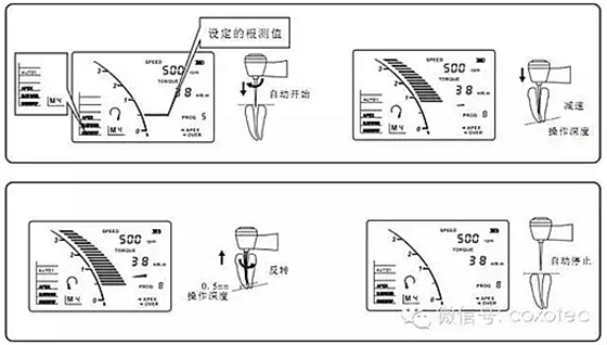 C-SMART-I+根管治療儀操作方法