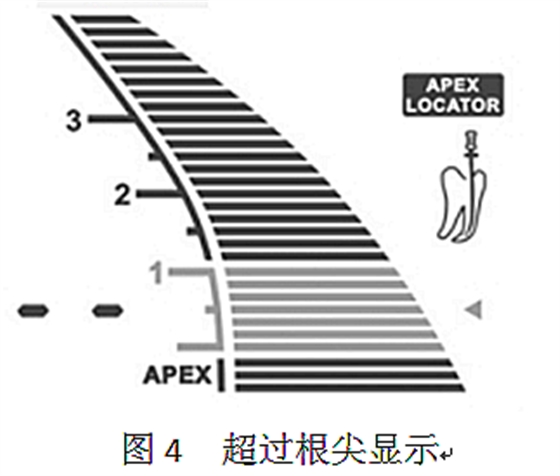 根管長度測量儀的使用