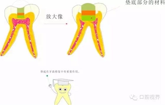 【愛牙科普知識300問】 “什么是活髓切斷術(shù)？”