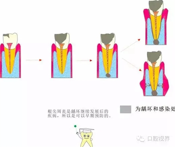 【愛牙科普知識300問】 “什么是牙本質敏感？”