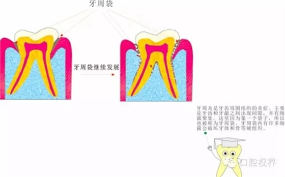 【愛牙科普知識300問】 “什么是牙本質敏感？”