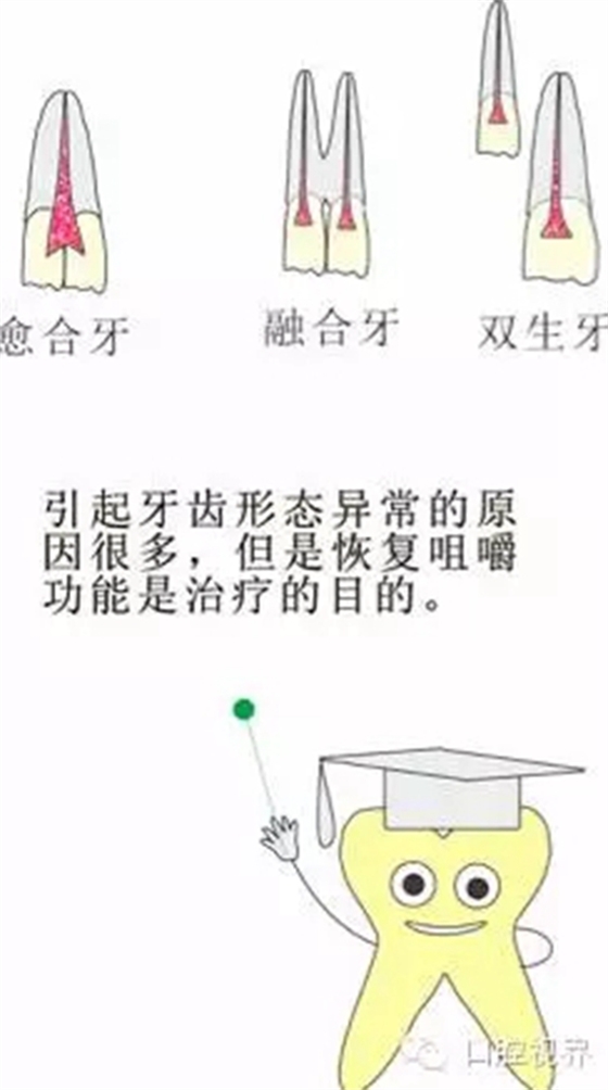 【愛牙科普知識300問】 “什么是融合牙、愈合牙和雙生牙？”