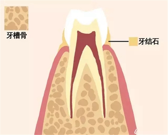 【愛(ài)牙科普】牙齒是如何脫落的…