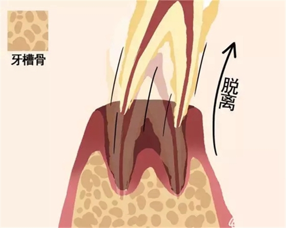 【愛(ài)牙科普】牙齒是如何脫落的…