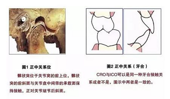 【臻美推薦】現代牙合學概念與全口固定義齒咬合重建