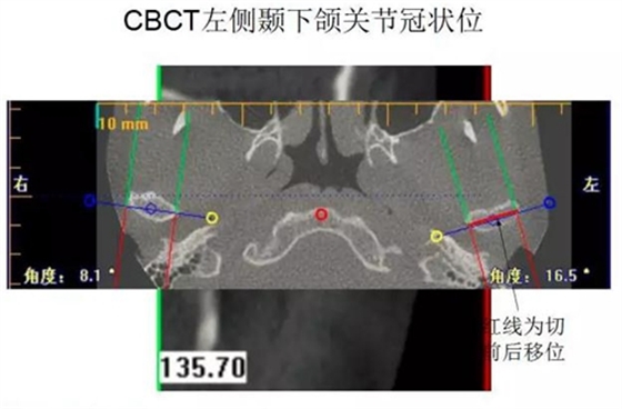 	口腔修復(fù)治療中，常見臨床接診流程