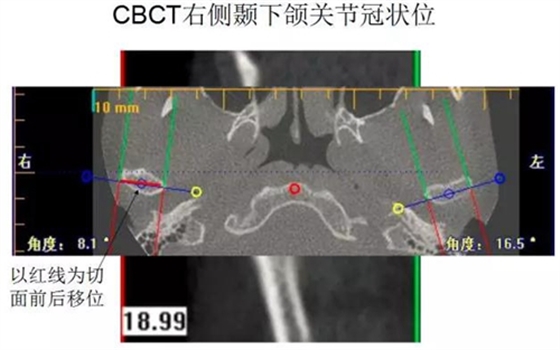 	口腔修復(fù)治療中，常見臨床接診流程