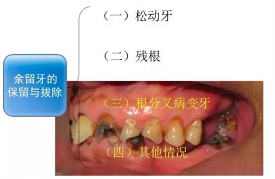 	口腔修復(fù)治療中，常見臨床接診流程