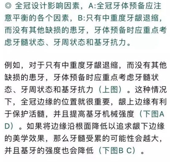 做全冠修復時基牙根面暴露，如何備牙？