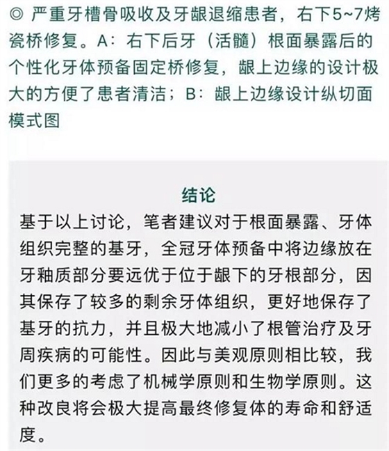 做全冠修復時基牙根面暴露，如何備牙？