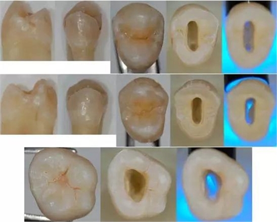各牙齒的大概的開髓形態
