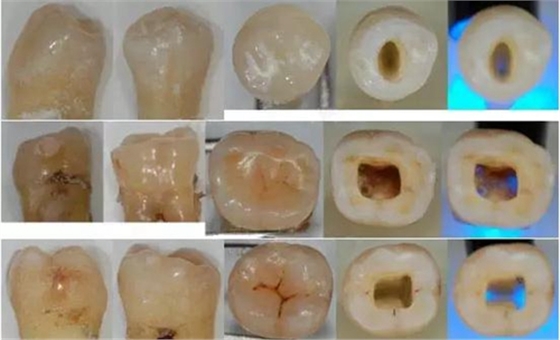各牙齒的大概的開髓形態