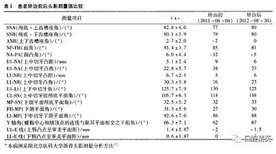 尖牙完全唇側(cè)錯(cuò)位擁擠，矯正1例  