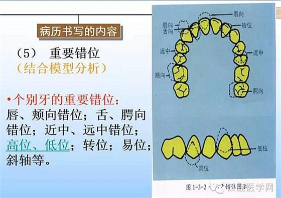 口腔正畸學(xué)病歷書寫  