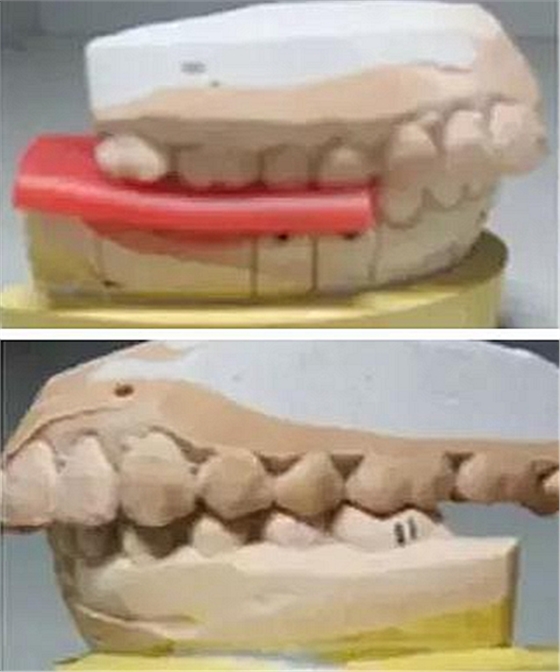 義齒加工技師想對醫生說的話