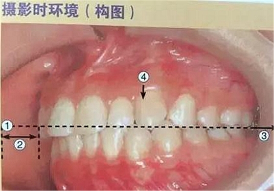 口腔攝影方法與技巧