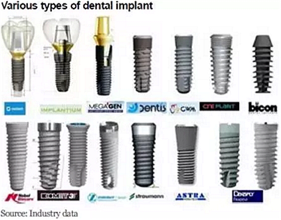 種植體，在全球牙科設備市場的變化！