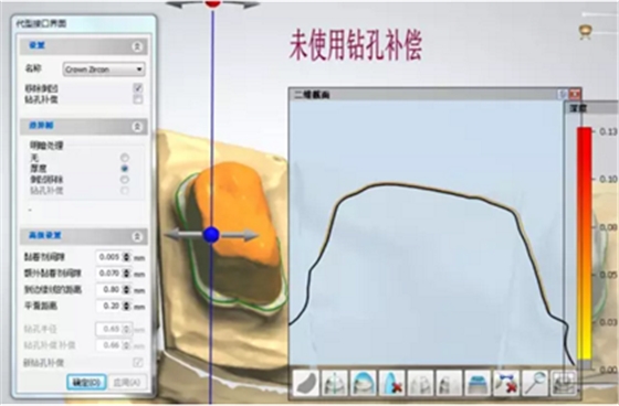 全鋯牙冠裂原因分析—操作流程工藝以及患者日常使用