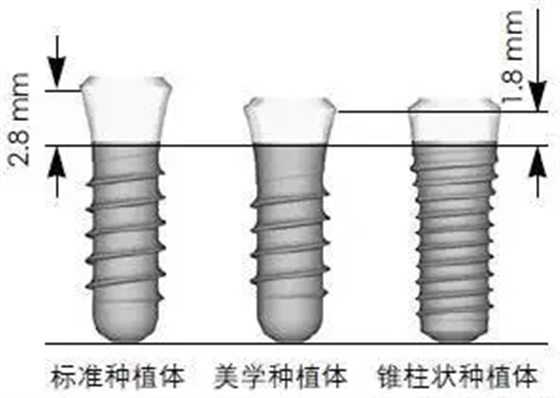 Sraumann種植系統外科操作流程