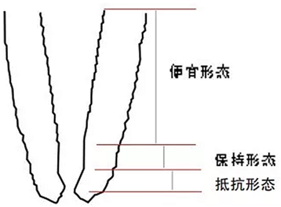 知識分享：規范化根管治療的細節分析