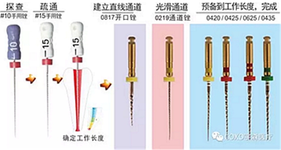 知識分享：根管治療的標準步驟