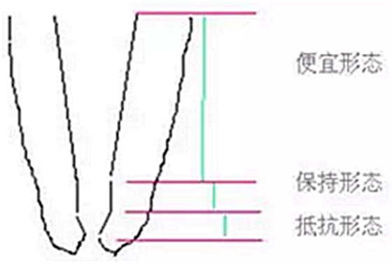 知識分享：根管治療的標準步驟