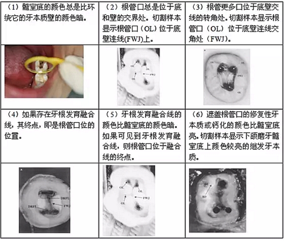 知識分享：根管治療的標準步驟