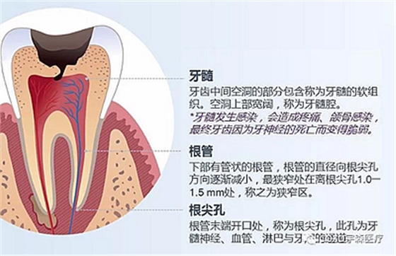 廠家來解說：多頻技術的根管長度測定儀