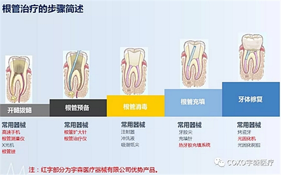 廠家來解說：多頻技術的根管長度測定儀