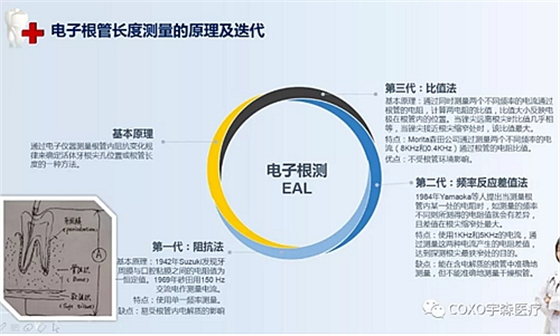 多頻技術的根管長度測定儀