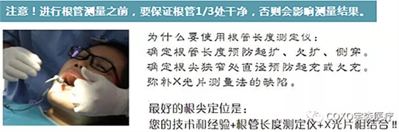 多頻技術的根管長度測定儀