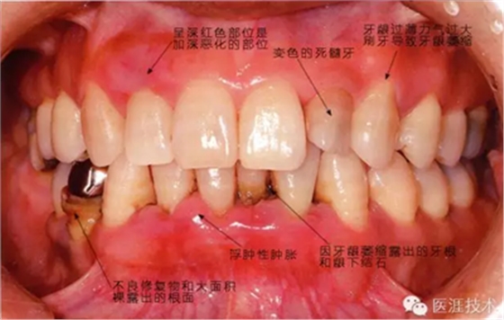 上海品瑞邁格磁致伸縮治療儀