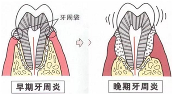 上海嘉福口腔研究所二十一世紀牙周病的臨床進展