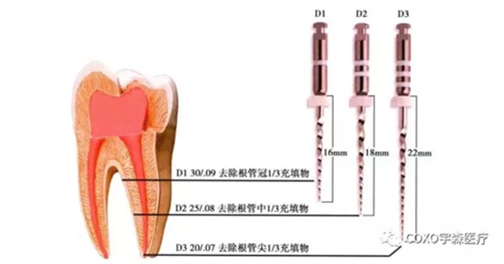 	（十一期）根管充填物的清理-牙膠的去除