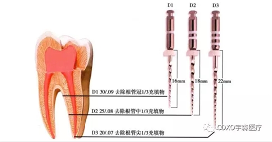 	（十一期）根管充填物的清理-牙膠的去除