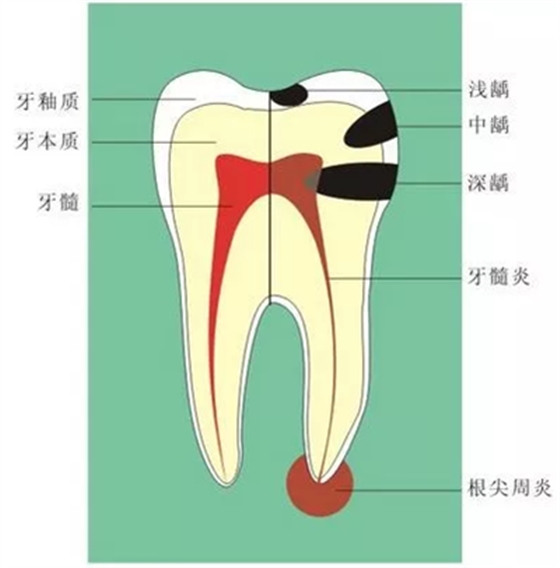 牙齦萎縮怎么辦？