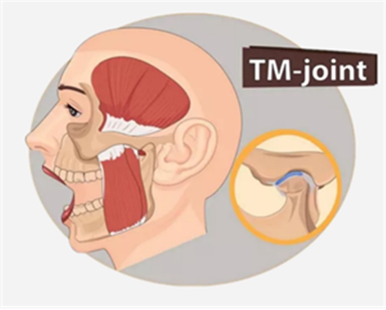 顳下頜關節紊亂病