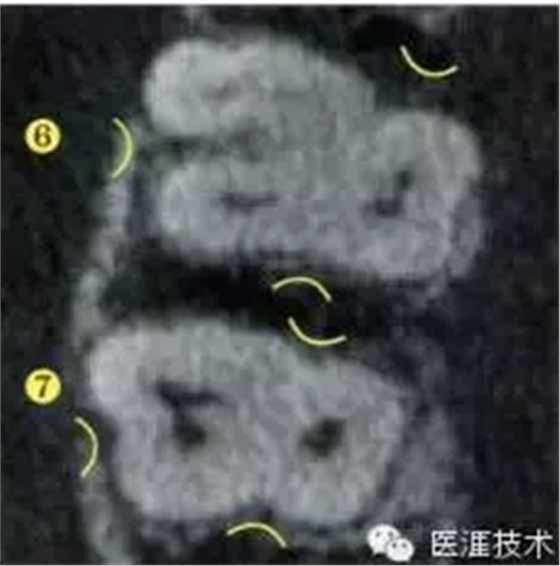 【牙周外科】牙齒的解剖形態（上篇）