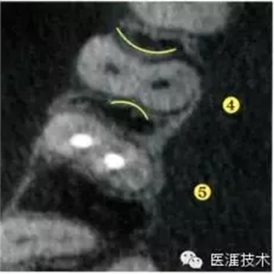 【牙周外科】牙齒的解剖形態（上篇）