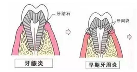 品瑞邁格磁致伸縮治療儀