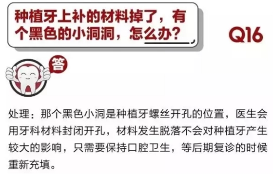 	 牙醫停診了？別怕，請您收下這份居家牙科急癥指南！