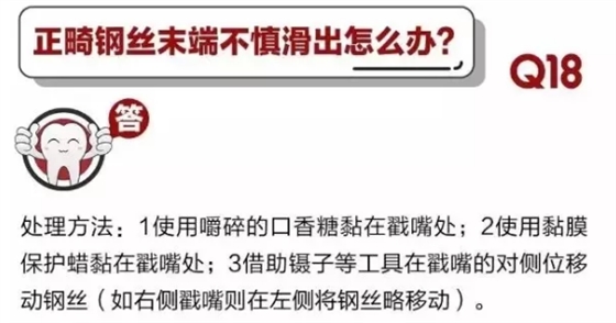 	 牙醫停診了？別怕，請您收下這份居家牙科急癥指南！