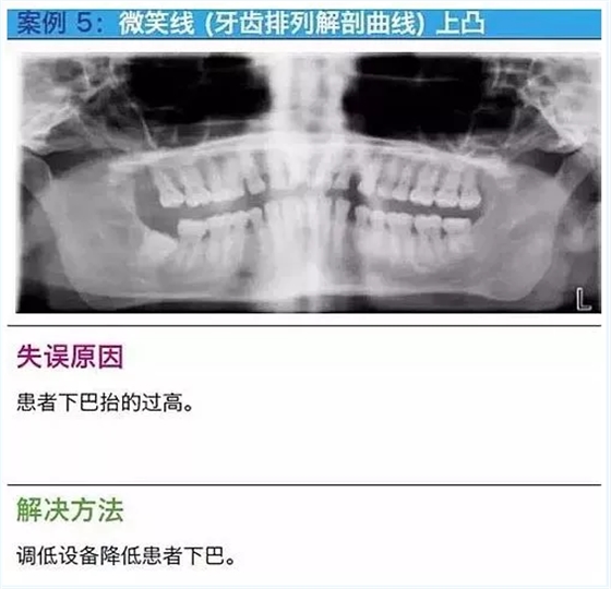 曲斷的10大經(jīng)典失誤案例及原因分析！