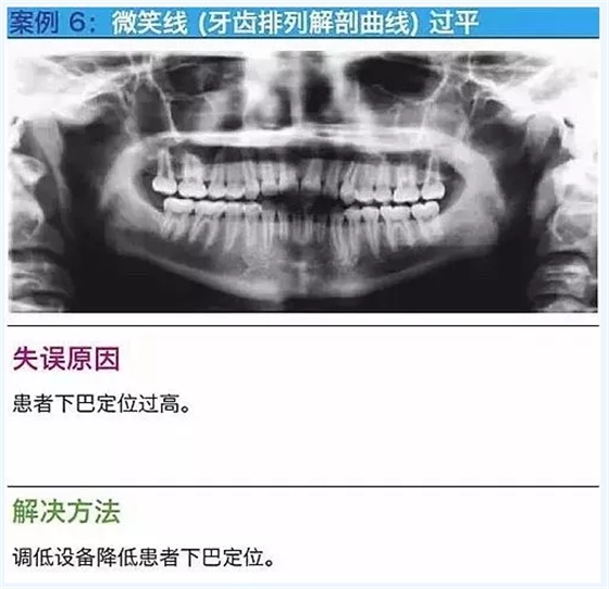 曲斷的10大經(jīng)典失誤案例及原因分析！