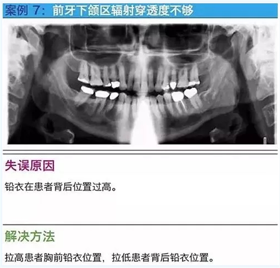 曲斷的10大經(jīng)典失誤案例及原因分析！