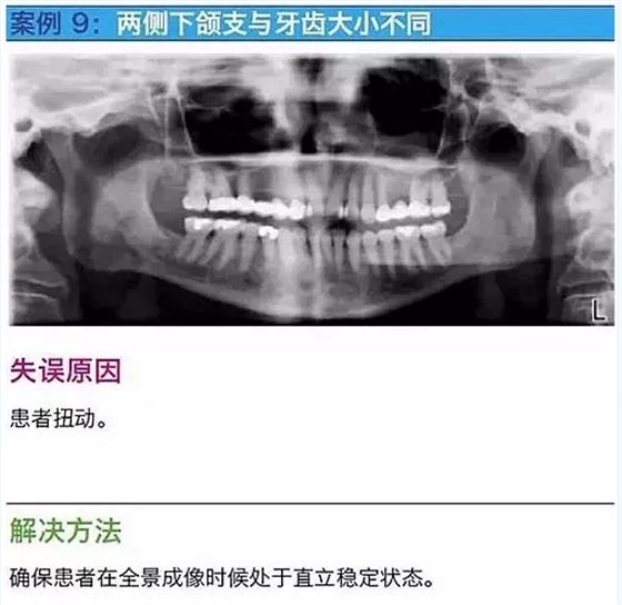 曲斷的10大經(jīng)典失誤案例及原因分析！