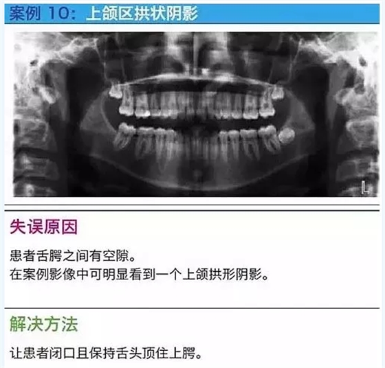 曲斷的10大經(jīng)典失誤案例及原因分析！